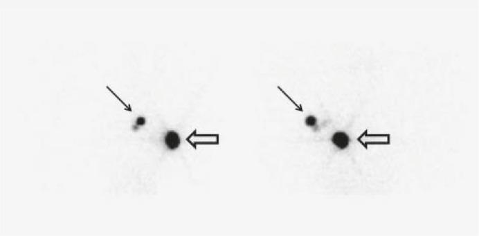 https://cdn.ncbi.nlm.nih.gov/pmc/blobs/0c46/3423739/74bae3188cf9/rado-45-03-184f2.jpg