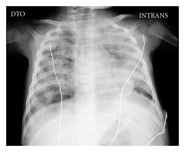 https://cdn.ncbi.nlm.nih.gov/pmc/blobs/0c5f/3202142/3e1495b71cac/CRIM2011-527569.001.jpg