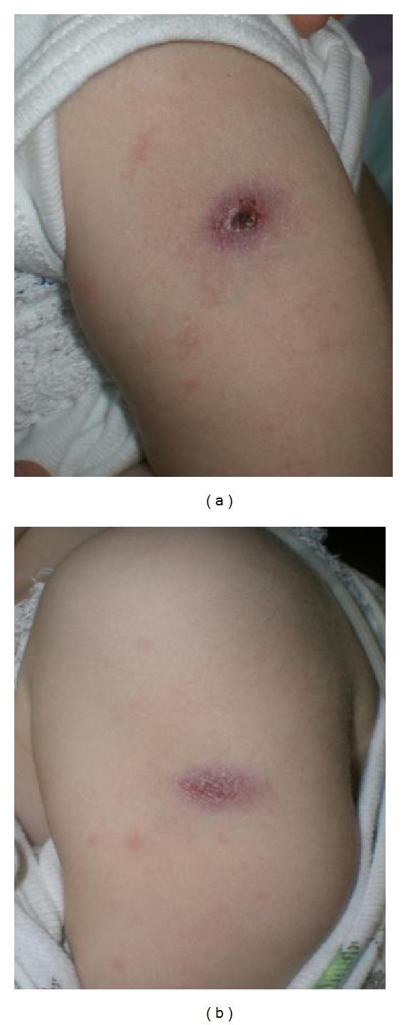 https://cdn.ncbi.nlm.nih.gov/pmc/blobs/0c5f/3202142/c2fd8c22fa0d/CRIM2011-527569.003.jpg