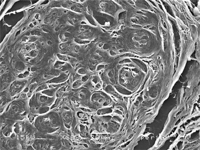 https://cdn.ncbi.nlm.nih.gov/pmc/blobs/0c66/2763065/c23dce00d7db/cln_64p1037f4.jpg