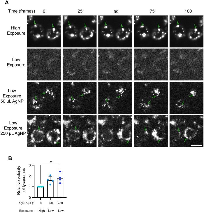 https://cdn.ncbi.nlm.nih.gov/pmc/blobs/0c68/10551705/9f1e694023ab/mbc-34-ar96-g010.jpg