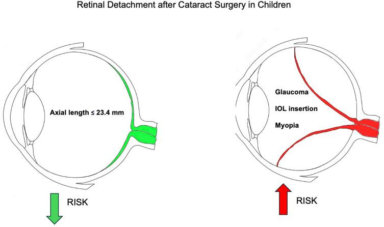 https://cdn.ncbi.nlm.nih.gov/pmc/blobs/0c69/11162630/a1d911f76e76/OPTH-18-1623-g0001.jpg