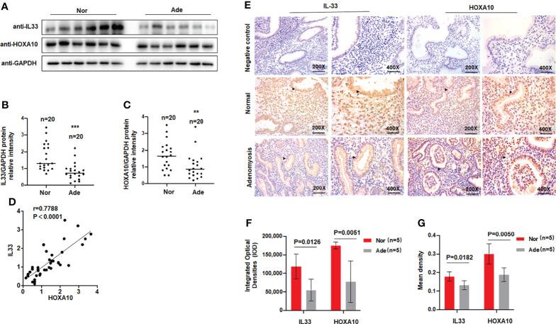 https://cdn.ncbi.nlm.nih.gov/pmc/blobs/0c75/9353328/0fa34f2951db/fendo-13-928024-g001.jpg