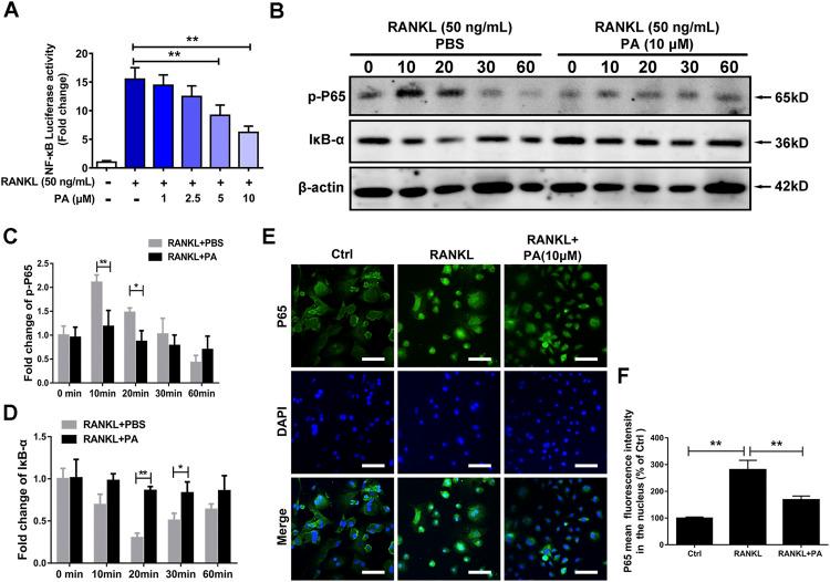 https://cdn.ncbi.nlm.nih.gov/pmc/blobs/0c76/8227438/39f2b1274a6f/fphar-12-684976-g004.jpg