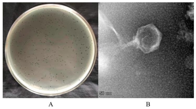 https://cdn.ncbi.nlm.nih.gov/pmc/blobs/0c79/12345913/b341af30cfb7/foods-14-02660-g001.jpg