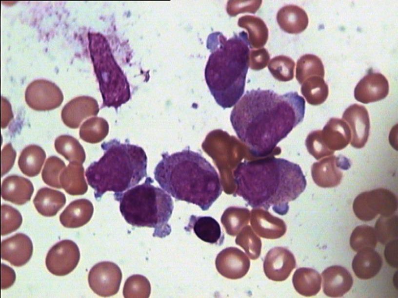 https://cdn.ncbi.nlm.nih.gov/pmc/blobs/0c83/6684484/c843d454c248/OTT-12-6157-g0001.jpg