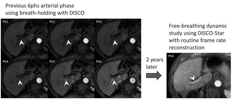 https://cdn.ncbi.nlm.nih.gov/pmc/blobs/0c8a/10086403/a22c3fbb0582/mrms-22-221-g5.jpg