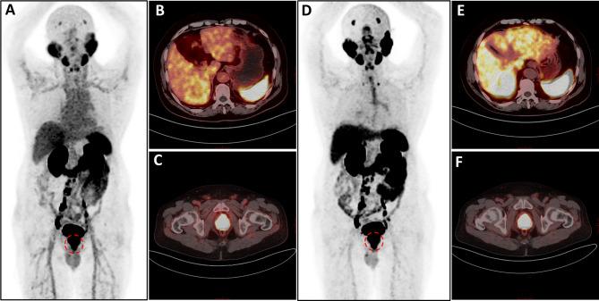https://cdn.ncbi.nlm.nih.gov/pmc/blobs/0c8b/12144303/27135c0c0e98/41598_2025_5344_Fig6_HTML.jpg