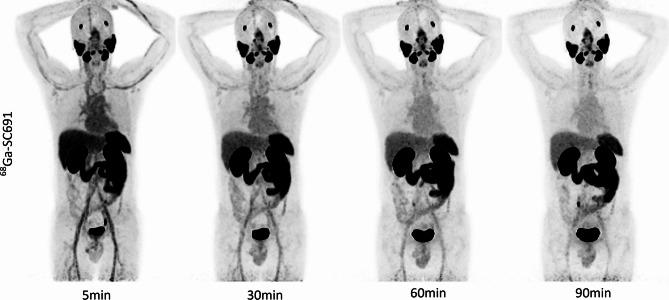 https://cdn.ncbi.nlm.nih.gov/pmc/blobs/0c8b/12144303/97ad1dfb9969/41598_2025_5344_Fig1_HTML.jpg