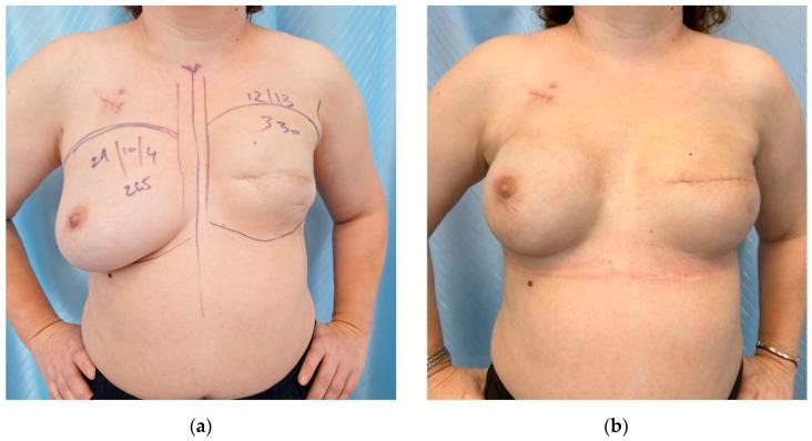 https://cdn.ncbi.nlm.nih.gov/pmc/blobs/0c8e/12248541/5bfc1965f5f6/cancers-17-02267-g008.jpg