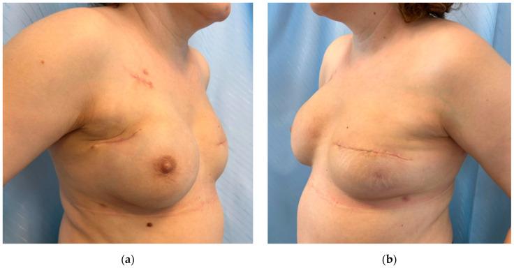https://cdn.ncbi.nlm.nih.gov/pmc/blobs/0c8e/12248541/c9910b0703ba/cancers-17-02267-g009.jpg