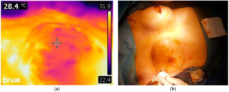 https://cdn.ncbi.nlm.nih.gov/pmc/blobs/0c8e/12248541/e0529d27f313/cancers-17-02267-g003.jpg