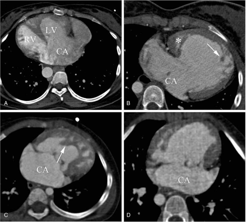 https://cdn.ncbi.nlm.nih.gov/pmc/blobs/0c96/6257481/84d4561814be/medi-97-e12983-g001.jpg