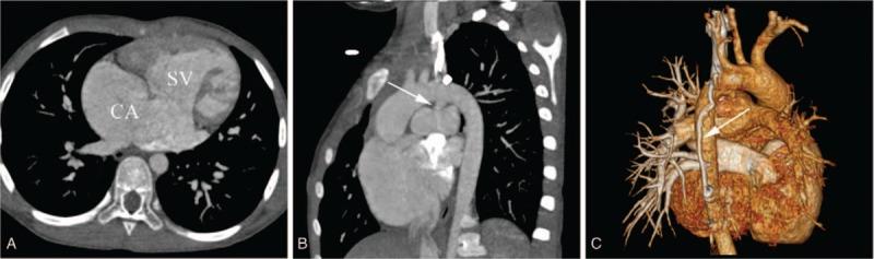 https://cdn.ncbi.nlm.nih.gov/pmc/blobs/0c96/6257481/b20bf06071a5/medi-97-e12983-g002.jpg