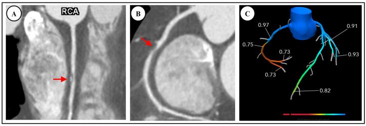 https://cdn.ncbi.nlm.nih.gov/pmc/blobs/0c97/11431535/6336fcd4c3ae/diagnostics-14-02096-g003.jpg