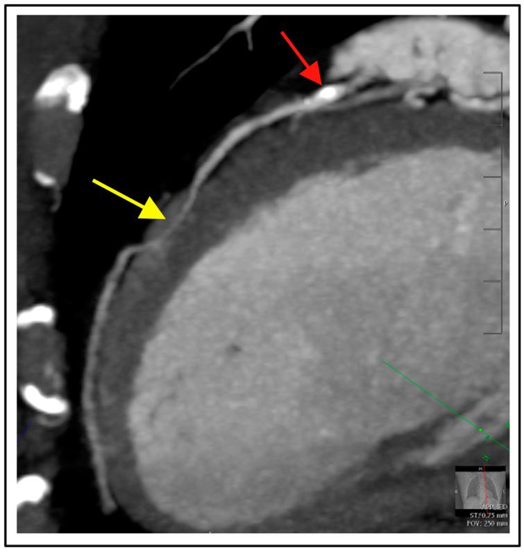https://cdn.ncbi.nlm.nih.gov/pmc/blobs/0c97/11431535/7ac8f624f23c/diagnostics-14-02096-g004.jpg