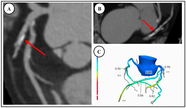 https://cdn.ncbi.nlm.nih.gov/pmc/blobs/0c97/11431535/d3ed6034c660/diagnostics-14-02096-g002.jpg