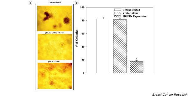 https://cdn.ncbi.nlm.nih.gov/pmc/blobs/0ca4/2242655/024ae81f8fb5/bcr1764-3.jpg