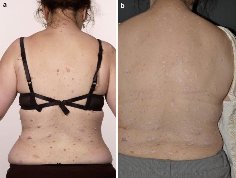 https://cdn.ncbi.nlm.nih.gov/pmc/blobs/0ca7/3721557/5e380141cf2f/13555_2012_7_Fig3_HTML.jpg