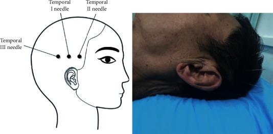 https://cdn.ncbi.nlm.nih.gov/pmc/blobs/0caa/7801060/bf0cbe1911ea/ECAM2021-8820324.002.jpg