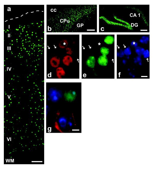 https://cdn.ncbi.nlm.nih.gov/pmc/blobs/0cac/2377267/58a134a8bc81/1471-2202-9-42-3.jpg