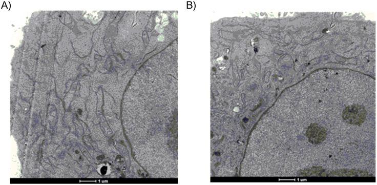 https://cdn.ncbi.nlm.nih.gov/pmc/blobs/0cae/4398407/671fe8f0f70a/pone.0123159.g007.jpg