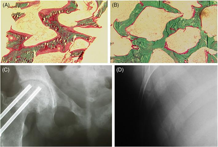 https://cdn.ncbi.nlm.nih.gov/pmc/blobs/0cb9/7839817/3564731a741f/JBM4-5-e10447-g001.jpg
