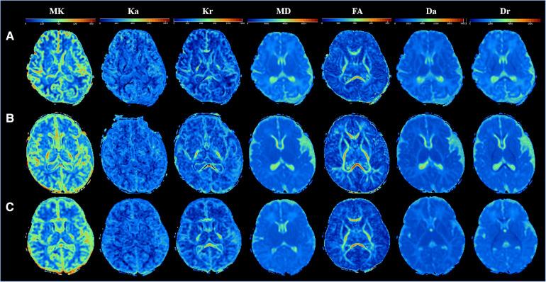 https://cdn.ncbi.nlm.nih.gov/pmc/blobs/0cbb/10083282/624ff5ef96ed/fped-11-1112121-g002.jpg