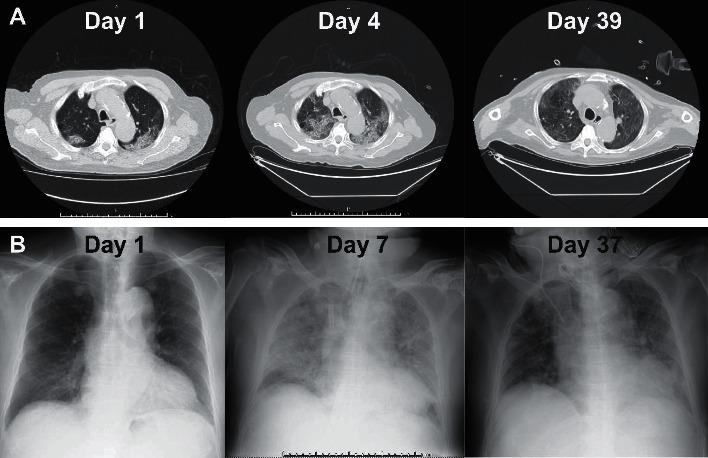 https://cdn.ncbi.nlm.nih.gov/pmc/blobs/0cbb/7475736/bdd52df41bce/CRIID2020-8814249.001.jpg