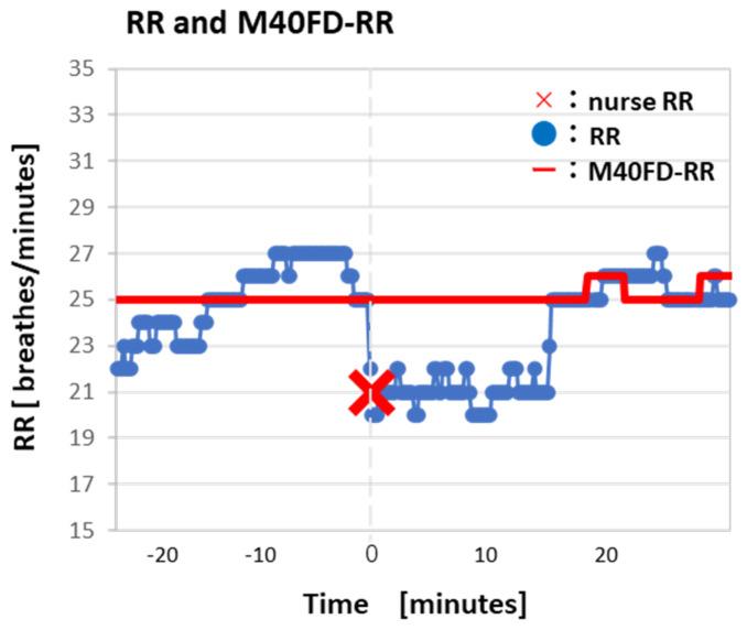 https://cdn.ncbi.nlm.nih.gov/pmc/blobs/0cbe/11598245/521afaedcded/sensors-24-07100-g004.jpg