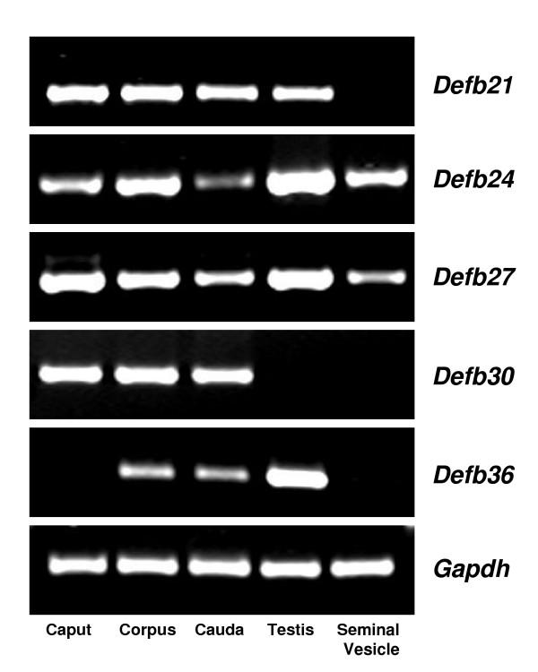 https://cdn.ncbi.nlm.nih.gov/pmc/blobs/0cbe/1420305/84e56a149a0c/1477-7827-4-7-3.jpg
