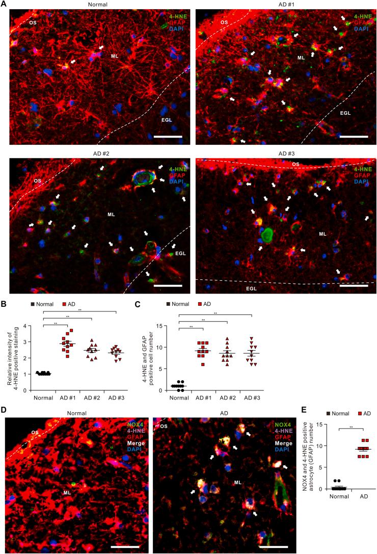 https://cdn.ncbi.nlm.nih.gov/pmc/blobs/0cc0/8027773/bb5bc50520bd/gr2.jpg