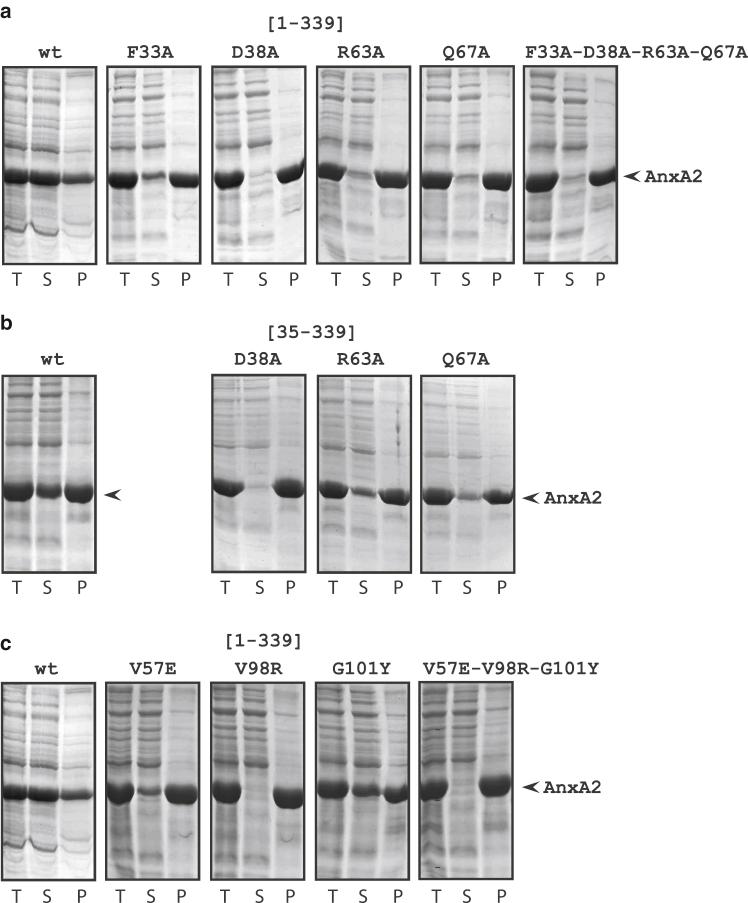 https://cdn.ncbi.nlm.nih.gov/pmc/blobs/0cc0/9748365/eaeb4eae8fae/gr2.jpg