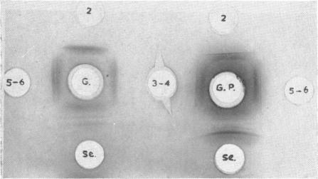https://cdn.ncbi.nlm.nih.gov/pmc/blobs/0cc2/1424017/686ce2a5aa0c/immunology00463-0062-a.jpg