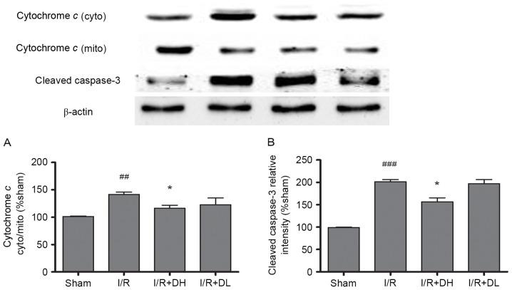 https://cdn.ncbi.nlm.nih.gov/pmc/blobs/0cc6/5865850/45492a7610d0/mmr-16-05-7229-g04.jpg