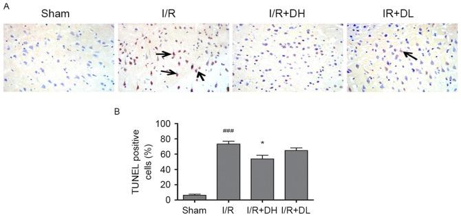 https://cdn.ncbi.nlm.nih.gov/pmc/blobs/0cc6/5865850/da8bb469d2c3/mmr-16-05-7229-g02.jpg