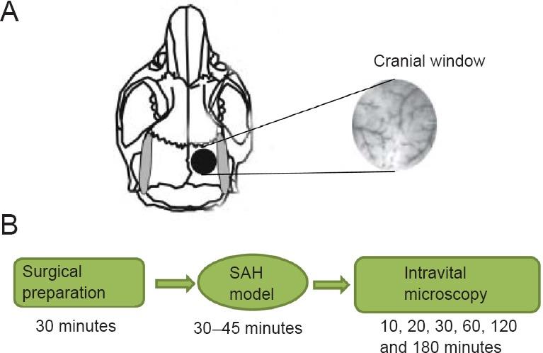 https://cdn.ncbi.nlm.nih.gov/pmc/blobs/0cc7/5900508/c55088caedc4/NRR-13-456-g002.jpg