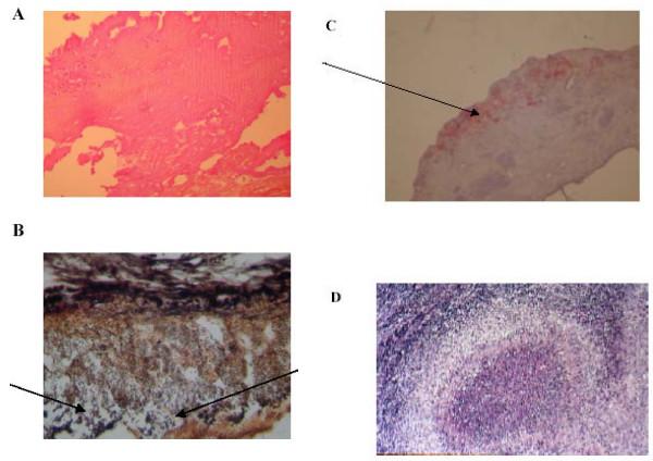 https://cdn.ncbi.nlm.nih.gov/pmc/blobs/0cd9/1868026/f61ef0b5e37f/1471-2334-7-30-1.jpg
