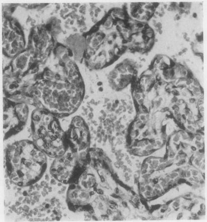 https://cdn.ncbi.nlm.nih.gov/pmc/blobs/0cd9/473965/849597fb3cd4/jclinpath00377-0102-a.jpg