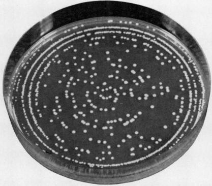 https://cdn.ncbi.nlm.nih.gov/pmc/blobs/0cd9/473965/b1b72355d73c/jclinpath00377-0103-b.jpg