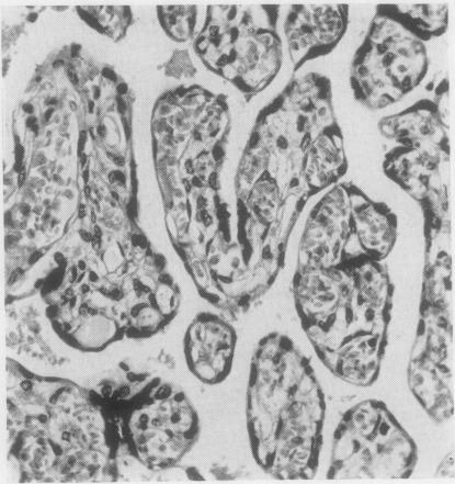 https://cdn.ncbi.nlm.nih.gov/pmc/blobs/0cd9/473965/db783d3f2ccf/jclinpath00377-0102-b.jpg