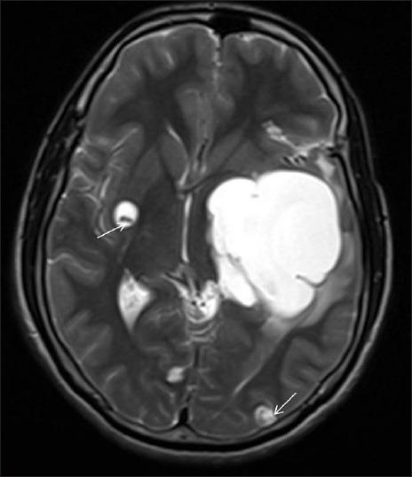 https://cdn.ncbi.nlm.nih.gov/pmc/blobs/0cdc/3788289/e6d2dcb6db42/AIAN-16-398-g001.jpg