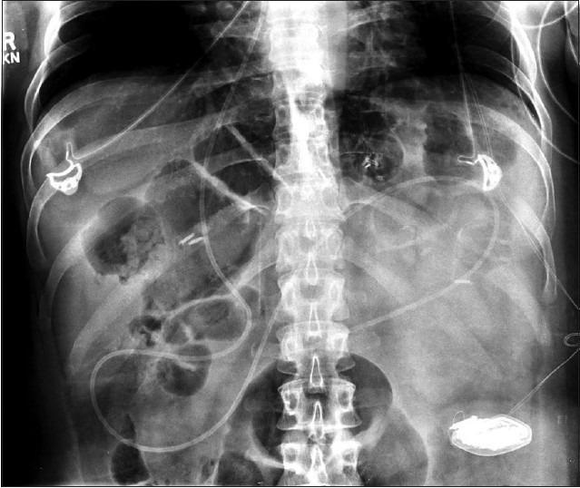 https://cdn.ncbi.nlm.nih.gov/pmc/blobs/0cdd/4244801/8eadae7f3eec/JNRP-6-97-g001.jpg