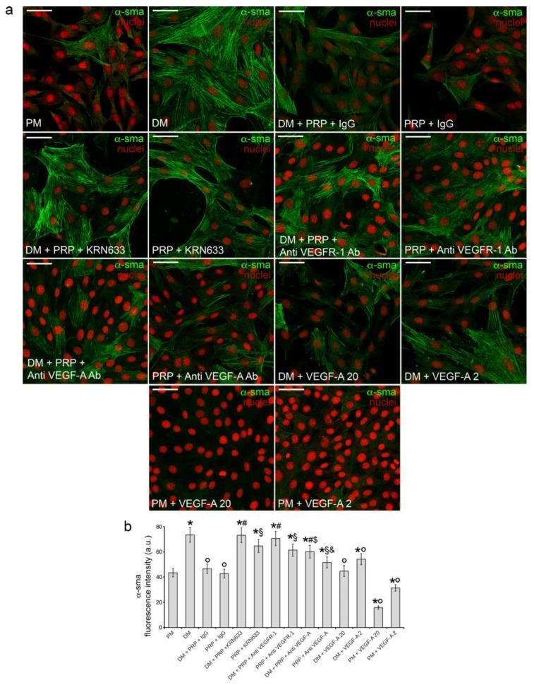 https://cdn.ncbi.nlm.nih.gov/pmc/blobs/0cdd/6162453/20375ac5df33/cells-07-00142-g005.jpg
