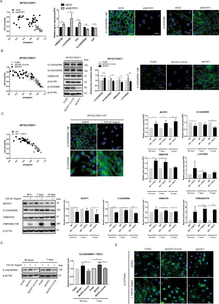 https://cdn.ncbi.nlm.nih.gov/pmc/blobs/0cdf/8677621/96dbc5d5fdb5/41388_2021_2062_Fig2_HTML.jpg
