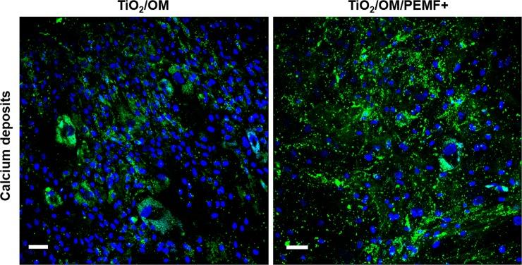 https://cdn.ncbi.nlm.nih.gov/pmc/blobs/0ce7/6002089/025eb900ced9/pone.0199046.g005.jpg