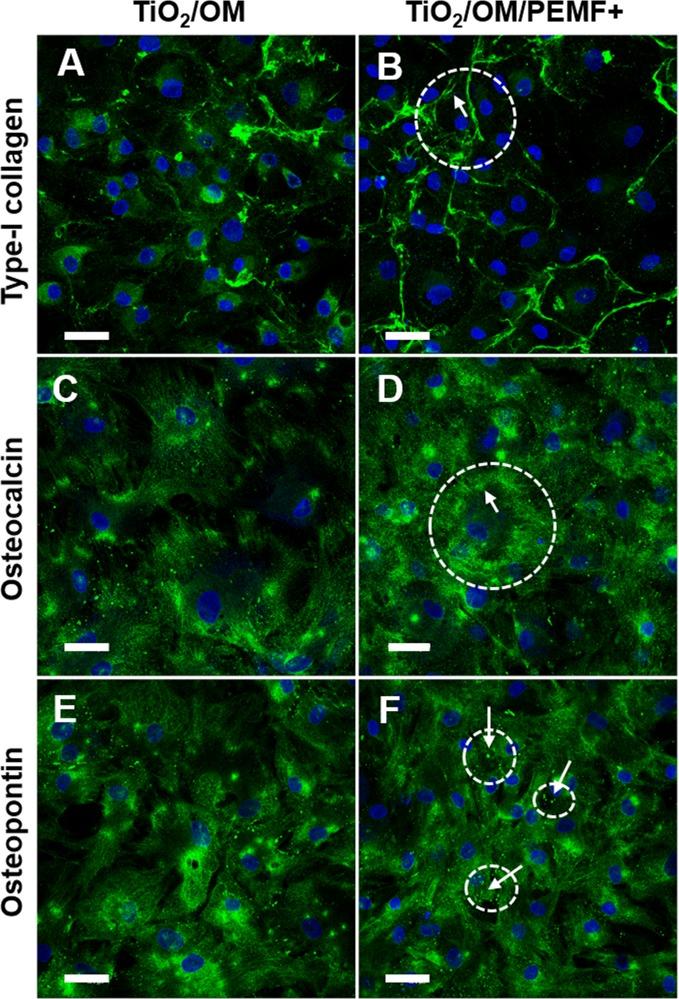 https://cdn.ncbi.nlm.nih.gov/pmc/blobs/0ce7/6002089/26c8ca2a51bb/pone.0199046.g003.jpg