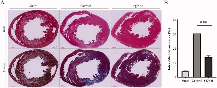 https://cdn.ncbi.nlm.nih.gov/pmc/blobs/0ce9/8903779/5d29178e4ef4/IPHB_A_2038207_F0006_C.jpg