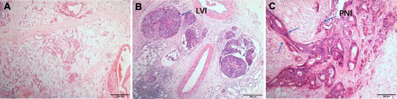 https://cdn.ncbi.nlm.nih.gov/pmc/blobs/0ced/9808960/4941aea43167/12885_2022_10416_Fig1_HTML.jpg