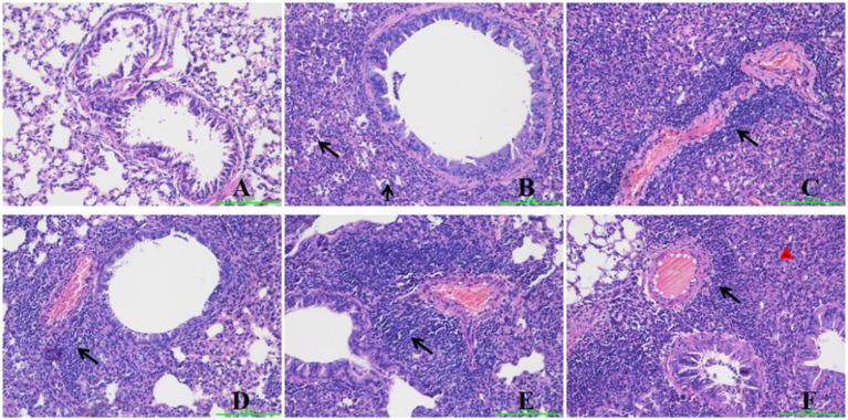 https://cdn.ncbi.nlm.nih.gov/pmc/blobs/0cef/12405357/6da297ae75b6/fmicb-16-1641008-g002.jpg